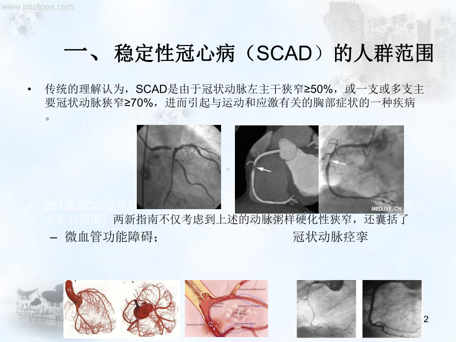 稳定性冠心病诊治要点课件.pptx_第2页