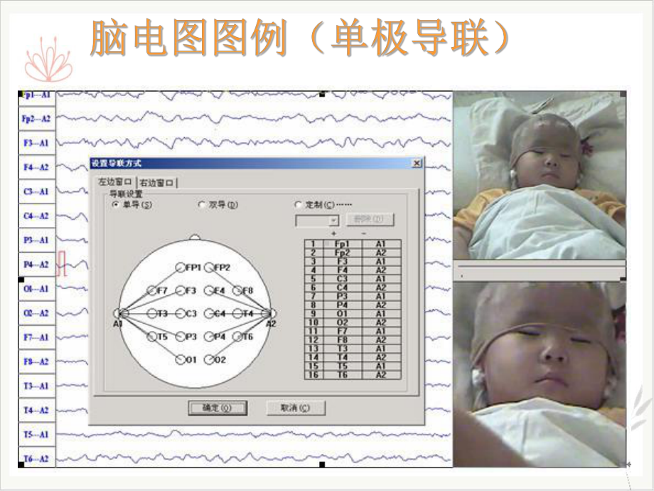 脑电图基础课件.ppt_第3页