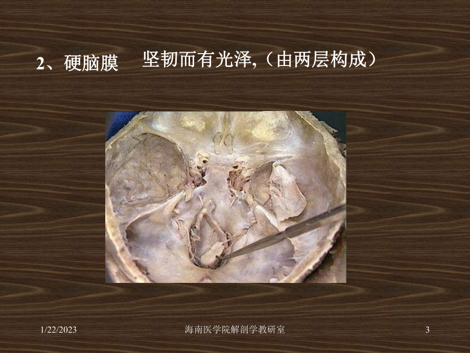 系统解剖概要脑脊髓被膜课件.ppt_第3页