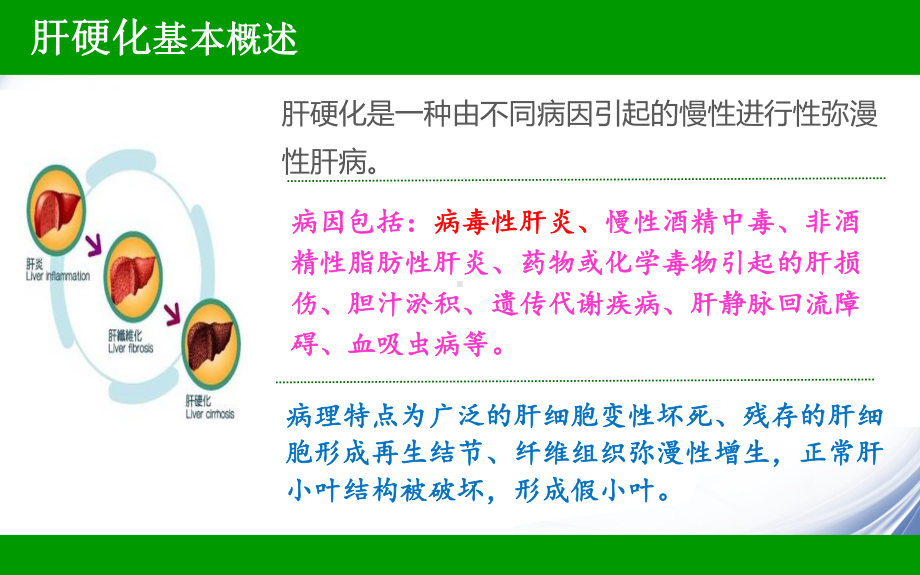 肝硬化失代偿期患者的护理查房(同名864)课件.ppt_第3页