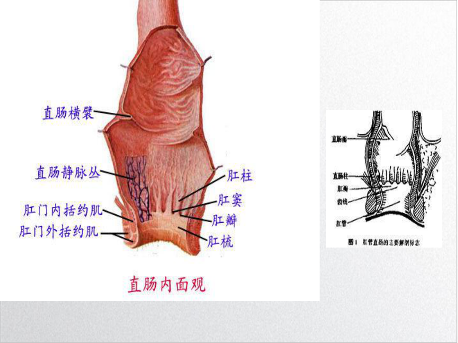 痔疮术后预防便秘护理实用版课件.ppt_第3页