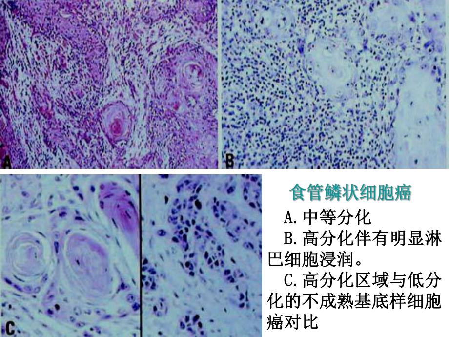 组织病理学诊断消化下课件.pptx_第2页