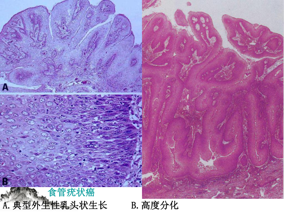 组织病理学诊断消化下课件.pptx_第3页