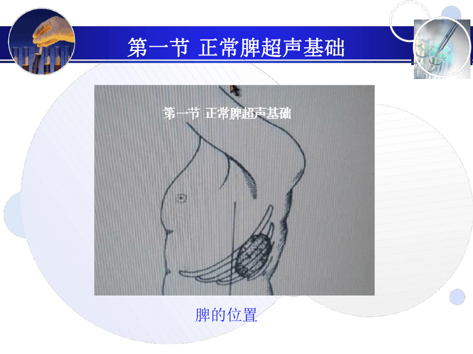 管理资料脾破裂的超声诊断汇编课件.ppt_第3页