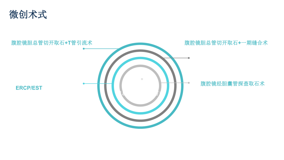 胆管结石腹腔镜手术规范标准课件.ppt_第3页