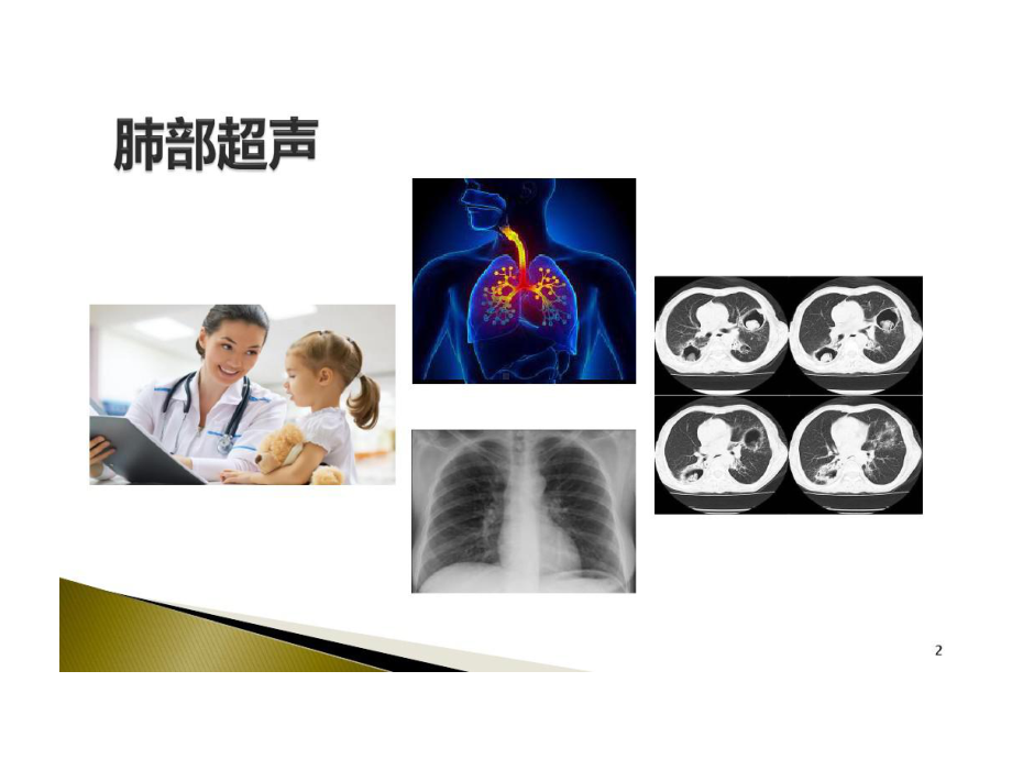 肺部超声临床应用课件.ppt_第2页