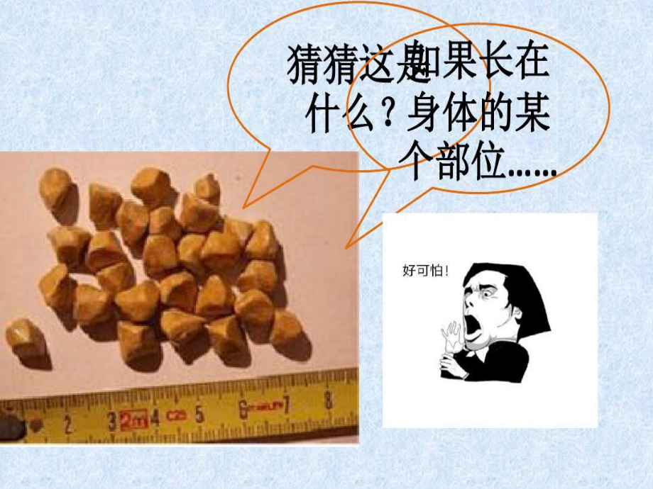 胆结石健康教育完善版课件.ppt_第2页