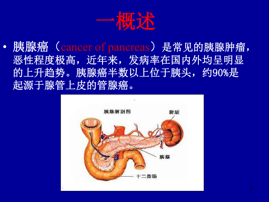 胰腺癌诊疗规范课件.ppt_第2页