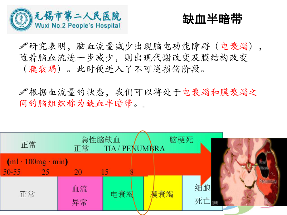 缺血性卒中影像学新进展课件.pptx_第2页