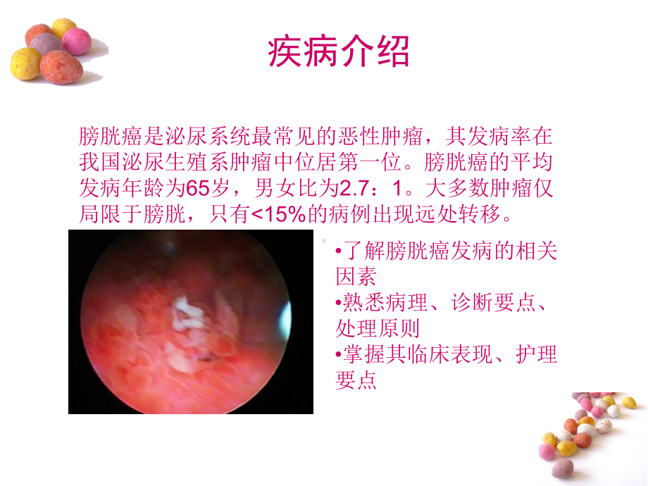 膀胱肿瘤病人的护理(同名966)课件.ppt_第2页