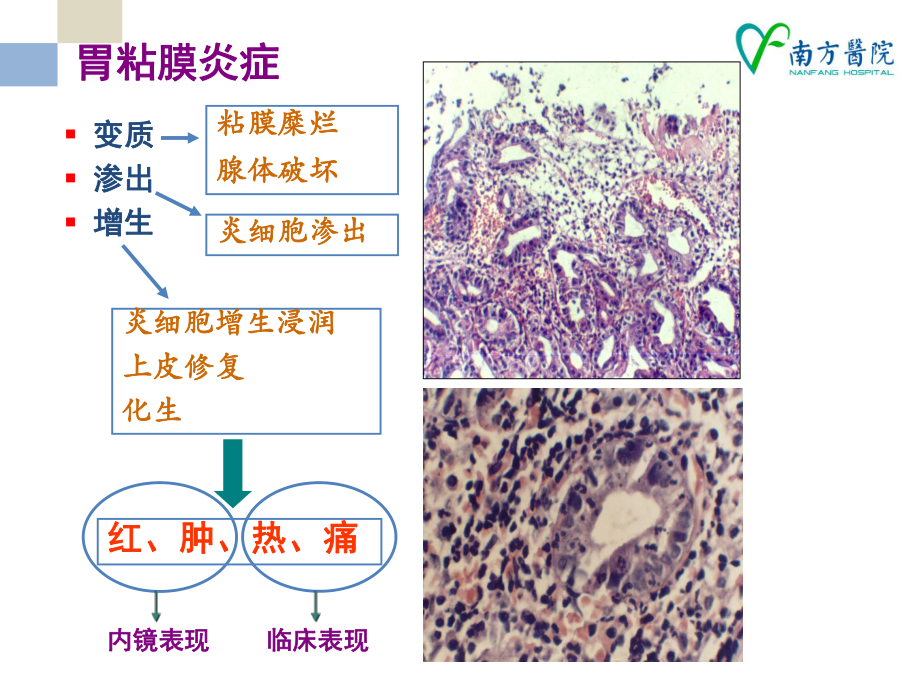 胃炎临床诊疗课件.pptx_第3页