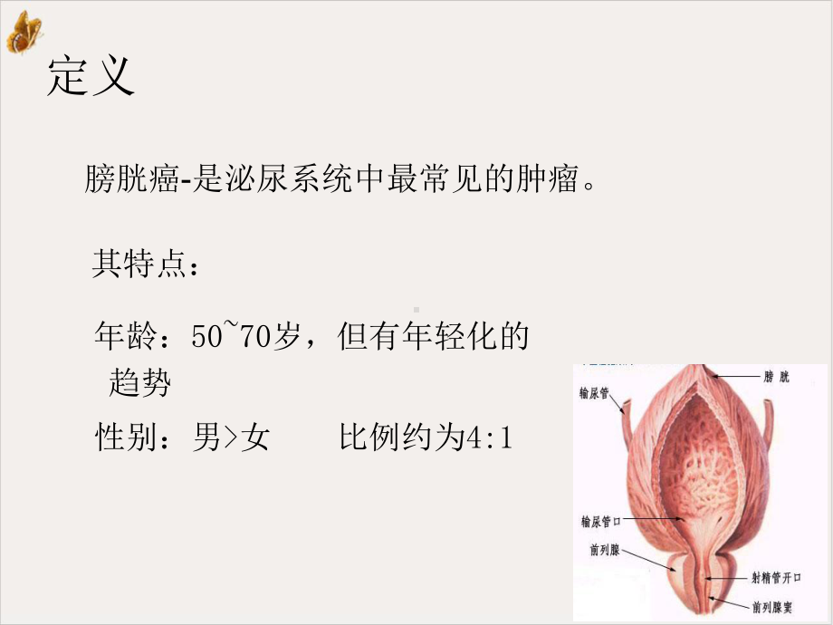 膀胱癌护理课件.pptx_第3页