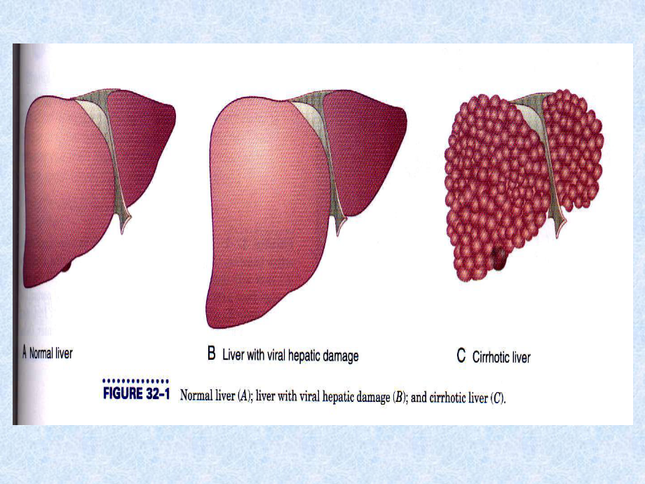 肝胆生化与肝脏疾病课件.ppt_第3页