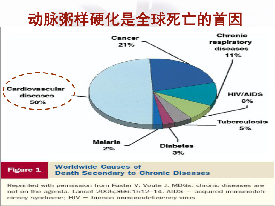 糖尿病患者的血脂管理课件.pptx_第2页