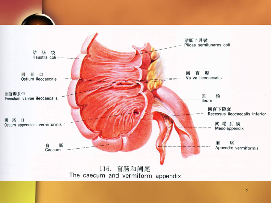 腹部疾病病人的护理课件.ppt_第3页