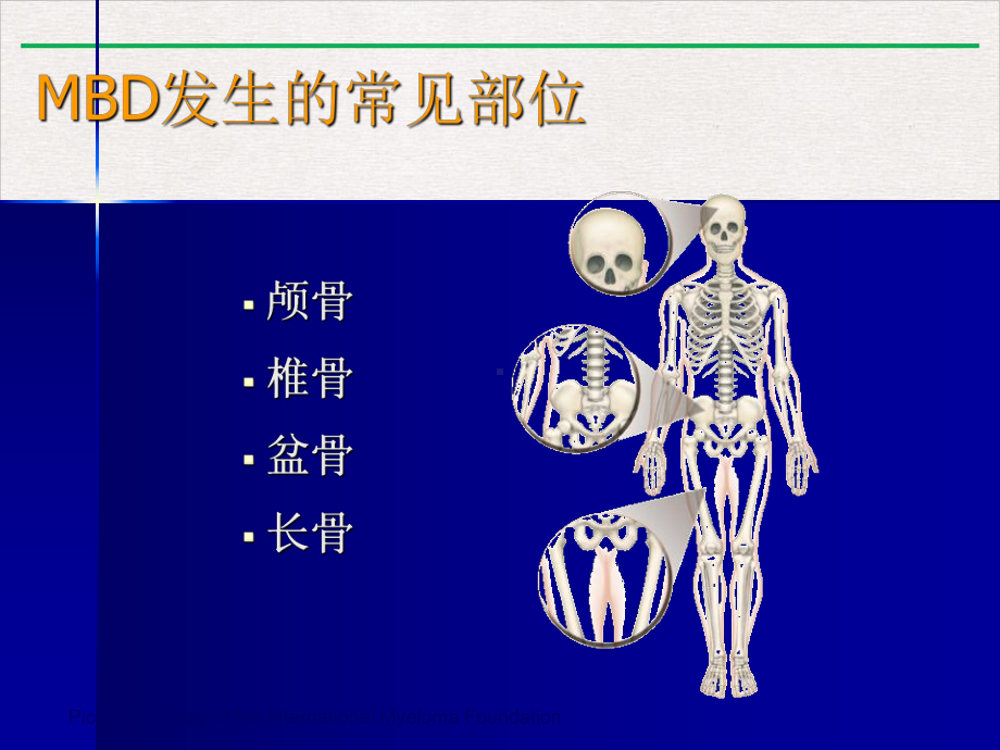 病的发生和治疗以及万珂对骨病的影响教学课件.pptx_第2页