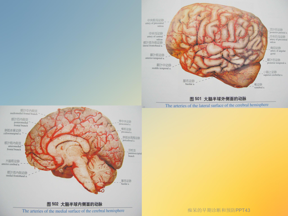 痴呆的早期诊断和预防43课件.ppt_第2页