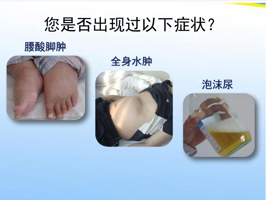 糖尿病患者教育糖尿病肾病篇课件.ppt_第2页