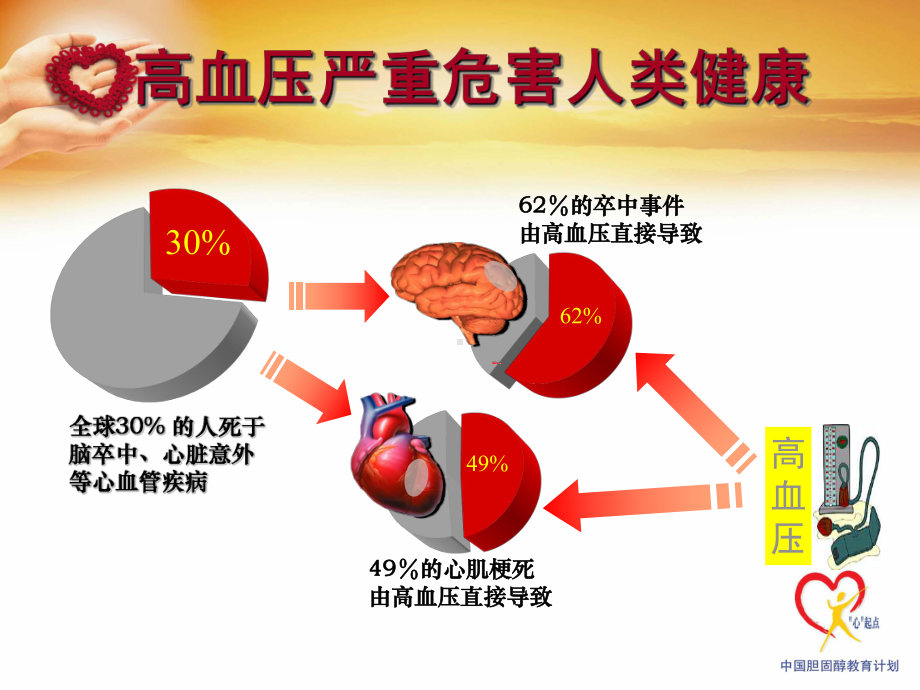 盖起明医师谈高血压健康教育课件.pptx_第2页