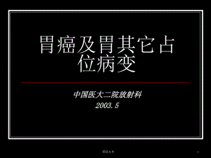 胃癌及胃其它占位病变影像学课件.ppt