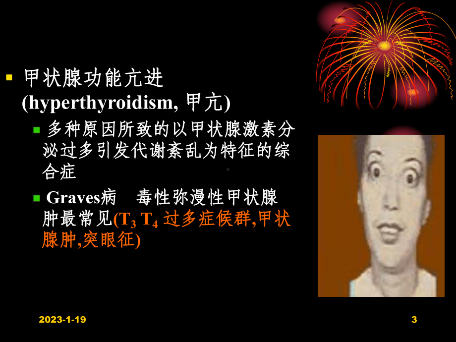 药理学-第36章-甲状腺激素及抗甲状腺药课件.ppt_第3页