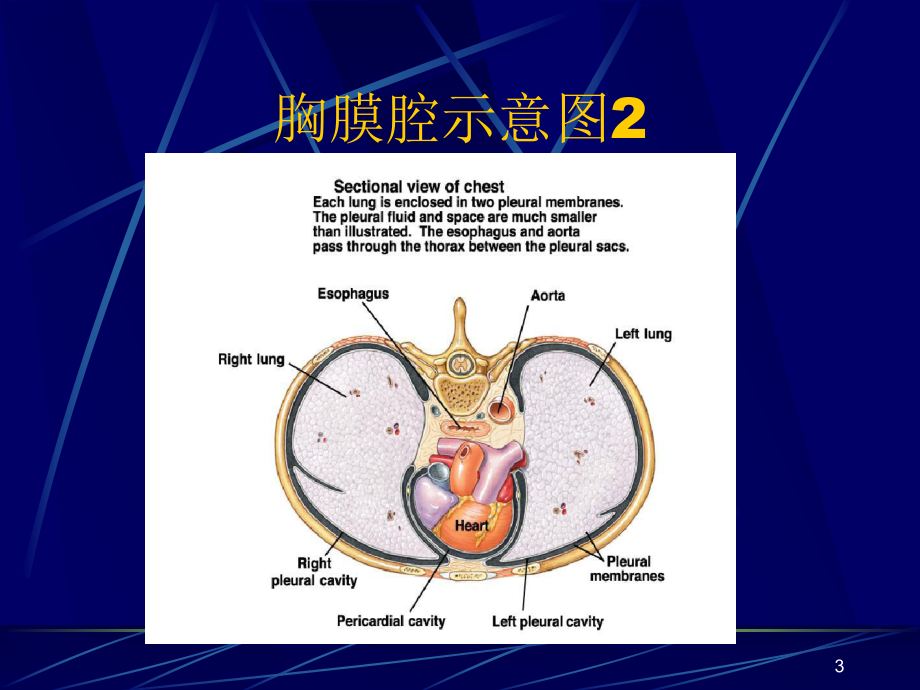 胸腔积液(pleuraleffusion)课件.ppt_第3页