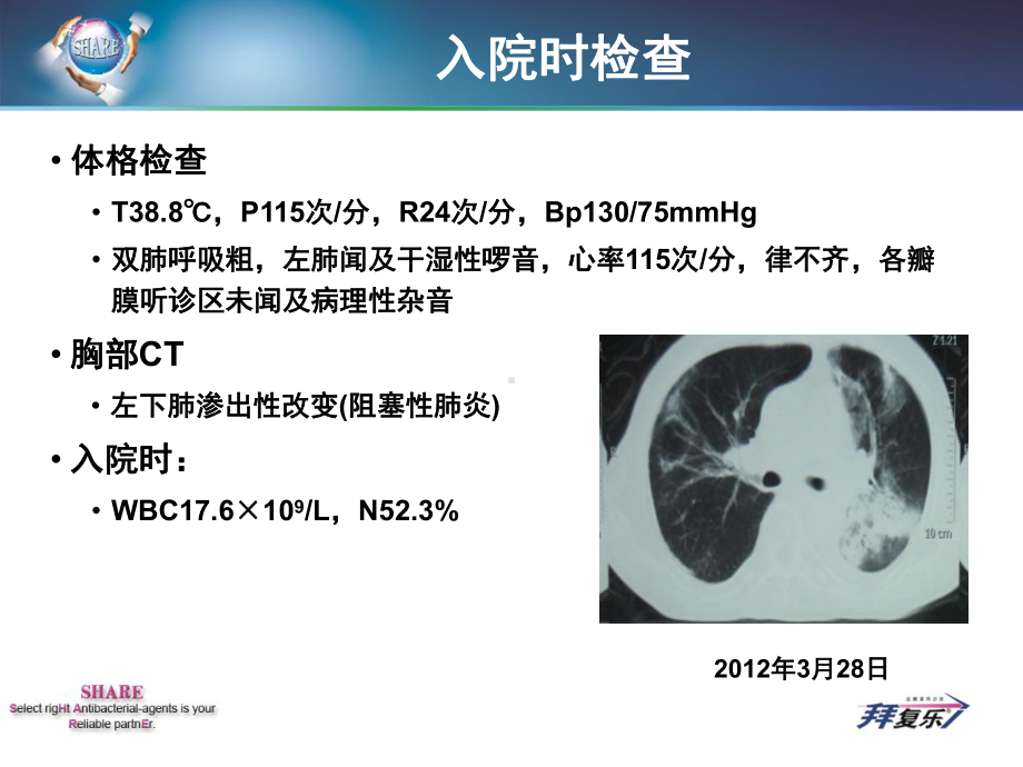 莫西沙星治疗肺癌合并阻塞性肺炎课件.ppt_第3页