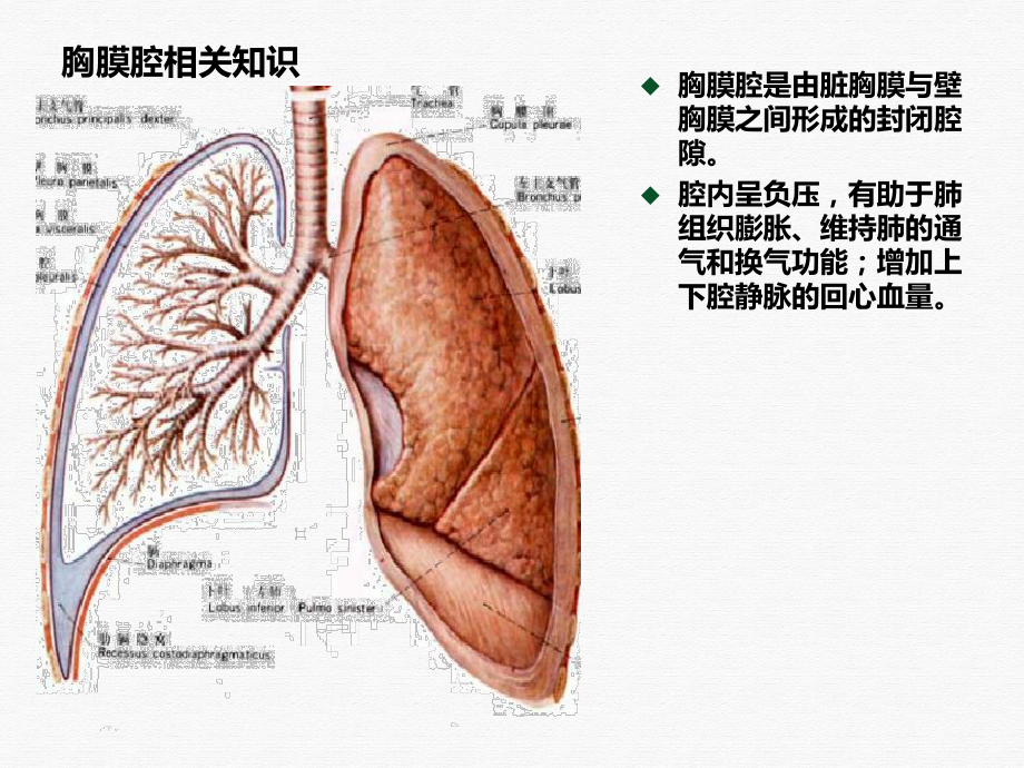 肺大疱及胸腔镜相关知识PPT课件.ppt_第3页