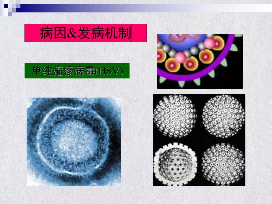 神经病学中枢神经系统感染课件整理.pptx_第3页