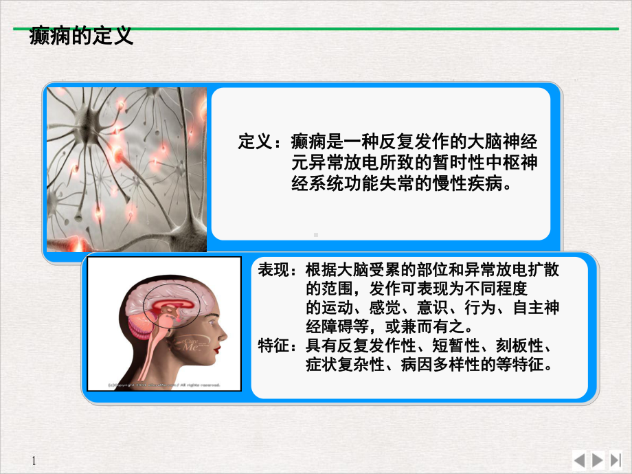 癫痫护理学习教学课件.pptx_第2页