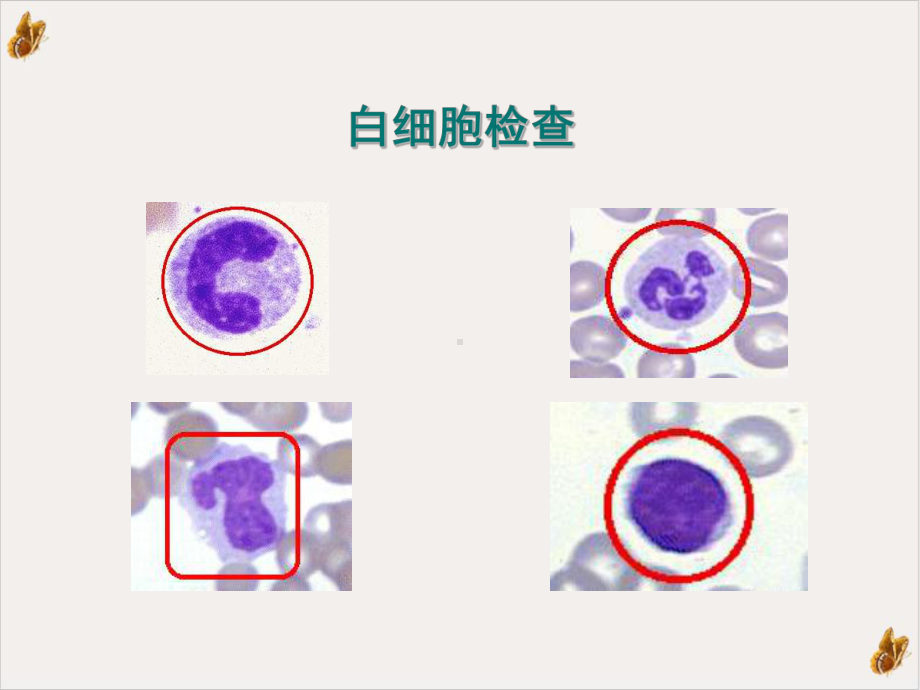 白细胞计数及分类计数课件.pptx_第1页