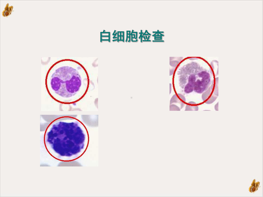 白细胞计数及分类计数课件.pptx_第2页