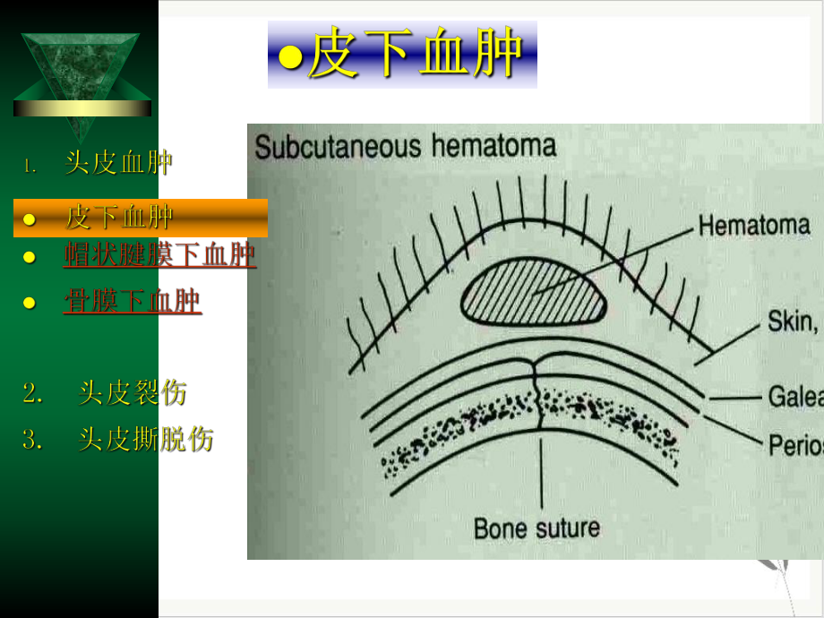 神经外科学PPT课件.pptx_第3页