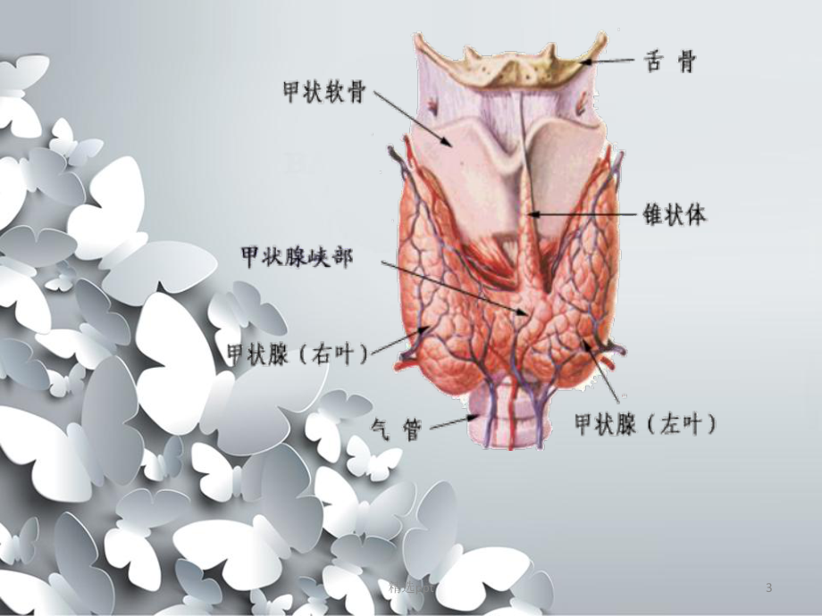 腔镜下甲状腺切除术课件.ppt_第3页