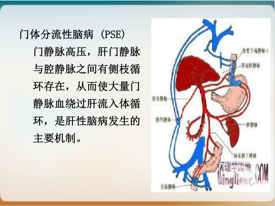 第四章内科护理学课件肝性脑病实用课件.ppt_第3页