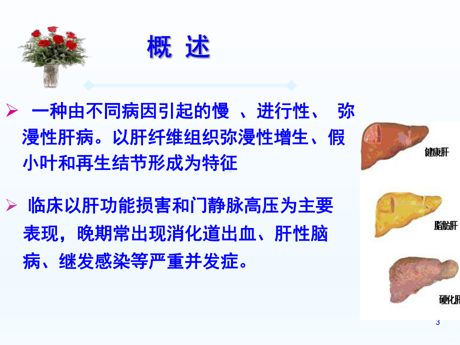 肝硬化病人的护理课件整理.ppt_第3页