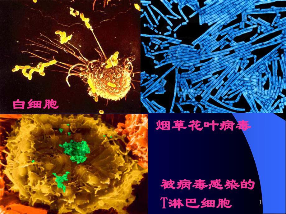 被病毒感染的T淋巴细胞课件.ppt_第1页