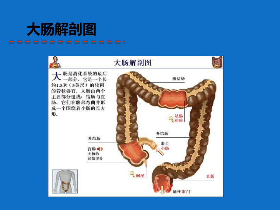 直肠癌护理查房(同名58)课件.ppt_第3页