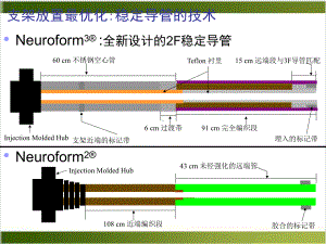 神经介入支架植入术选择课件.pptx