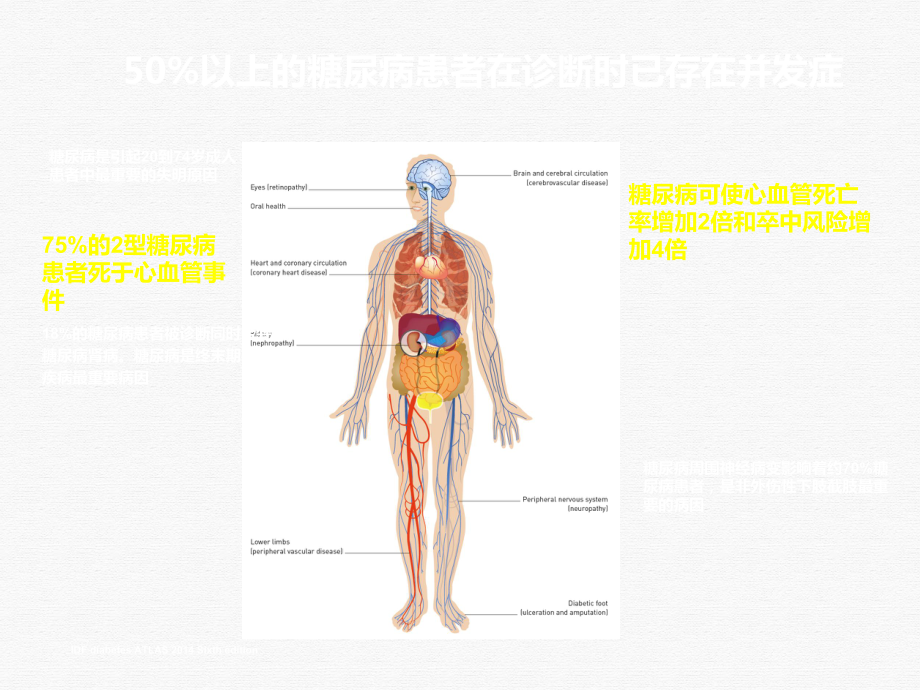 糖尿病与动脉粥样硬化及优化降脂策略课件.pptx_第2页