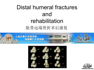 肱骨远端骨折术后康复课件.ppt