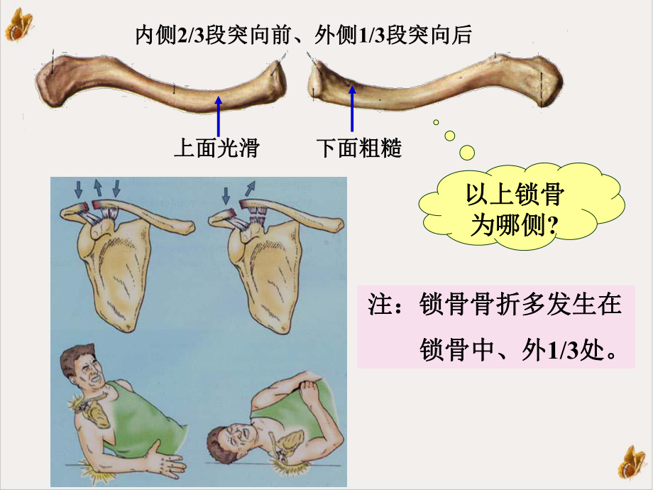 解剖学运动系统四肢骨及其连结临床专业课件.ppt_第3页