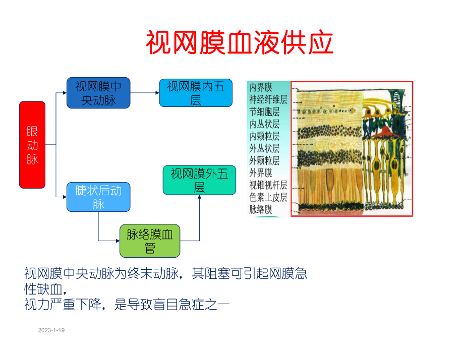 视网膜中央动脉阻塞课件.ppt_第3页