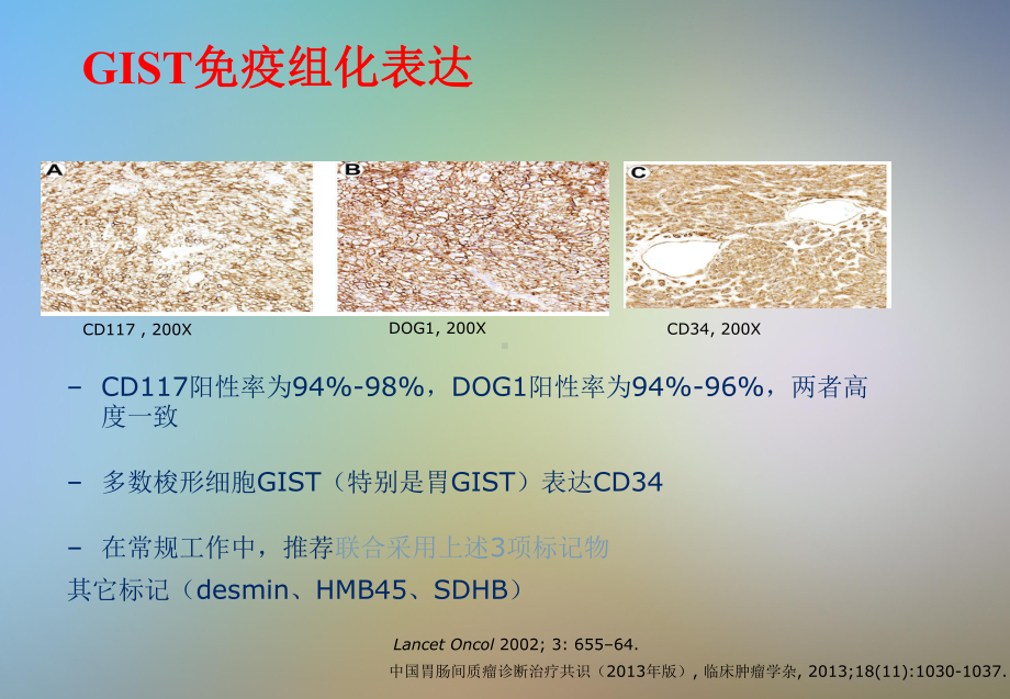 直肠胃肠道间质瘤课件.pptx_第3页