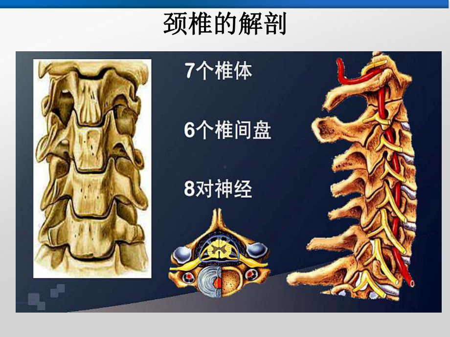 精选盘源性颈背及上肢疼痛课件资料.ppt_第3页