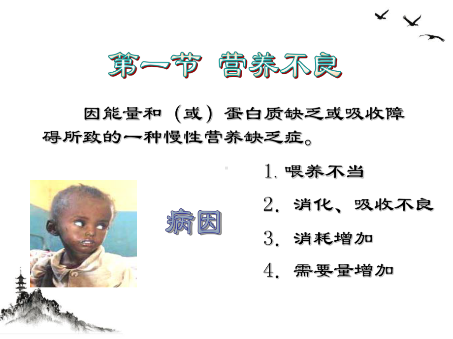 营养性疾病患儿的护理课件整理.ppt_第2页