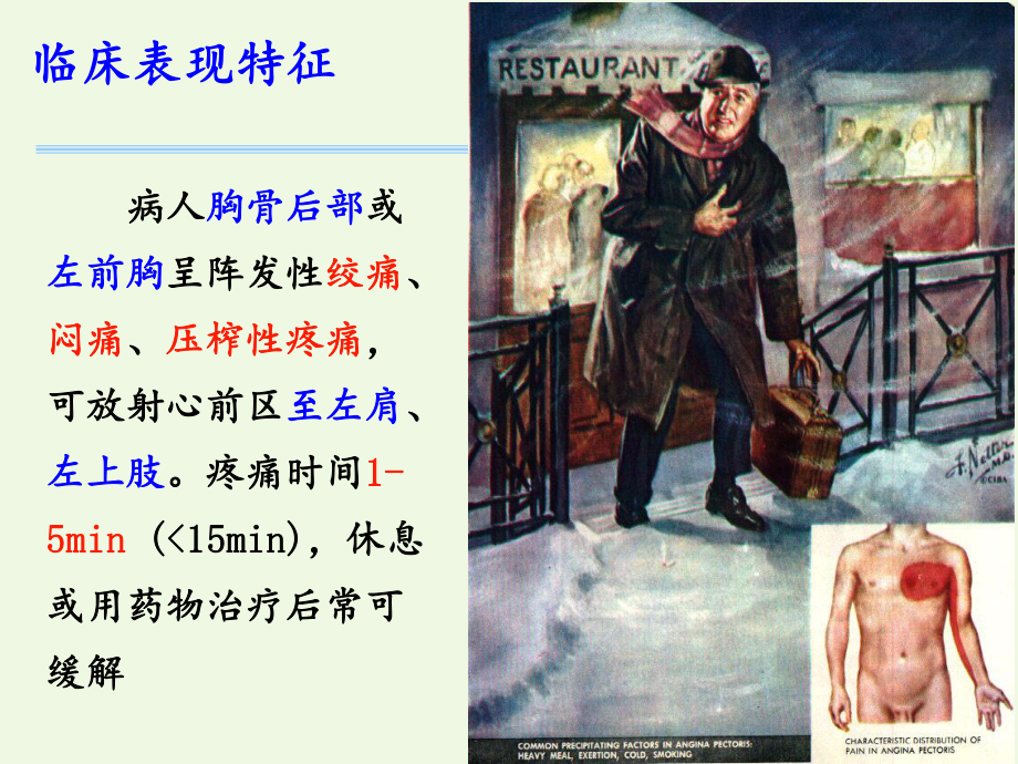 第28抗心绞痛药课件.ppt_第3页