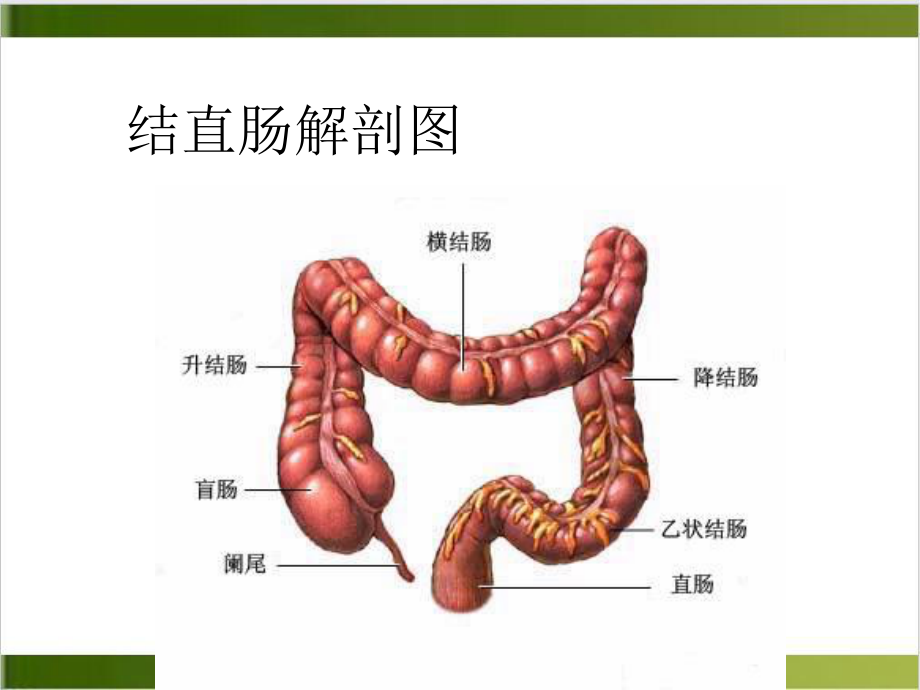 结肠癌和直肠癌的护理培训讲义课件.ppt_第3页