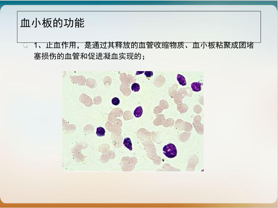 血小板减少症个案护理查房[1]课件.ppt_第3页