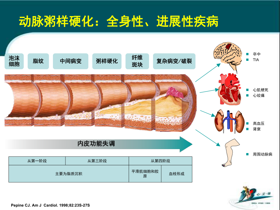 稳定性冠心病患者需要积极降脂治疗课件.pptx_第1页